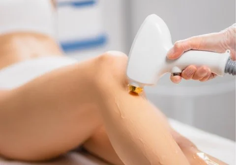 How laser hair removal works DiolazeXL