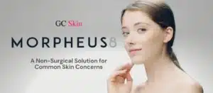 Morpheus8 A non surgical solution for common skin concerns