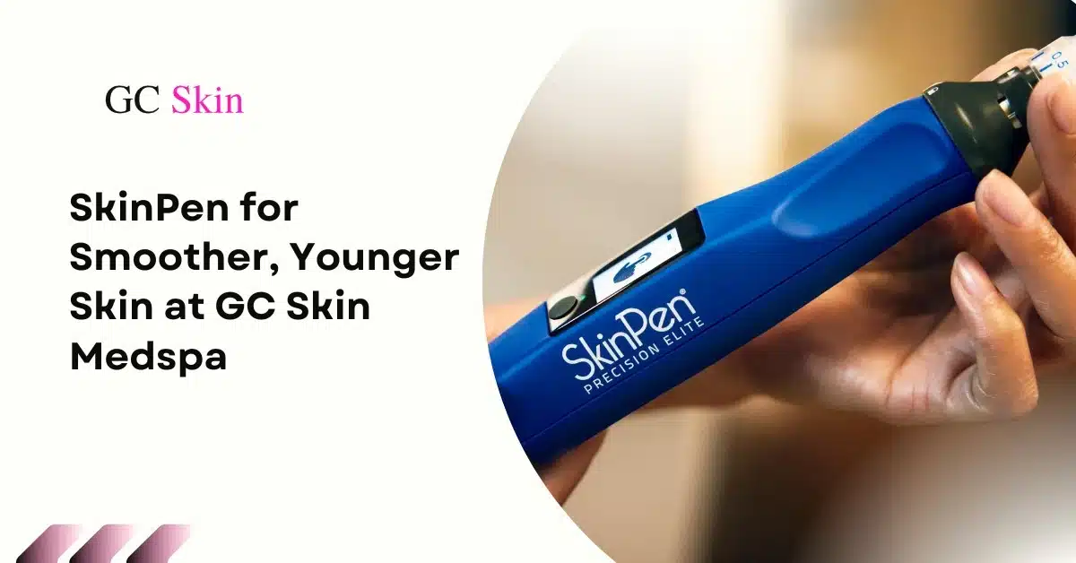 Microagujas en Sherman Oaks: SkinPen para una piel más suave y joven en GC Skin Medspa