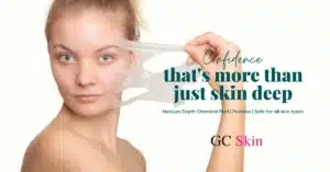VI Peeling en Sherman Oaks: Lo último en rejuvenecimiento de la piel en GC Skin Medspa